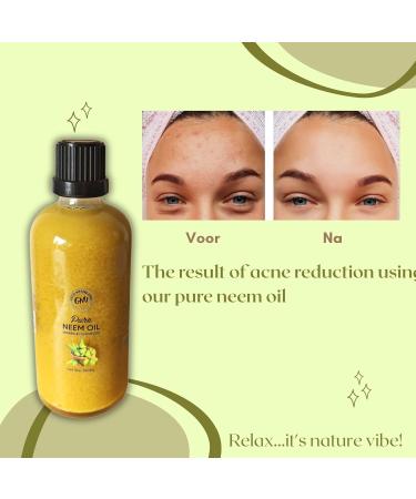 Good Nature Vibe Neem Oil 100 Pure Cold Pressed Natural Oil For Skin Hair Plant Care and Pets 100 ml - Buy Online on GoSupps.com