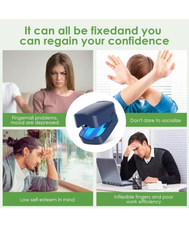 Home-Use Nail Fungus Laser Device with LED Blue Light Therapy - Buy Online on GoSupps.com