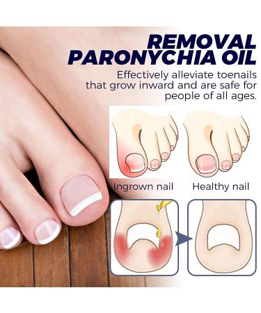 3PCS German Toenailcare Removal Paronychia Oil Treatment & Relief for Healthy Toenails - Buy Online on GoSupps.com