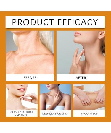 Vitamin C Turmeric Body Lotion Turmeric Body Lotion Deep Hydration Turmeric Body Treatment Lotion For Smooth Nourished & Moisturized Skin Repair Dry Skin (3) - Buy Online on GoSupps.com