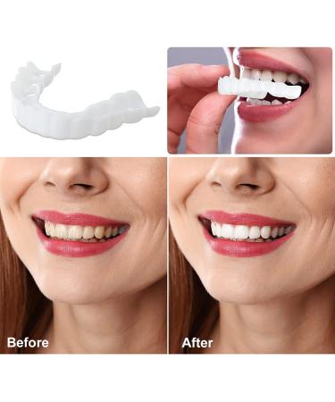 Snap-On Denture Smile Braces for Men and Women - Enhance Your Smile! - Buy Online on GoSupps.com