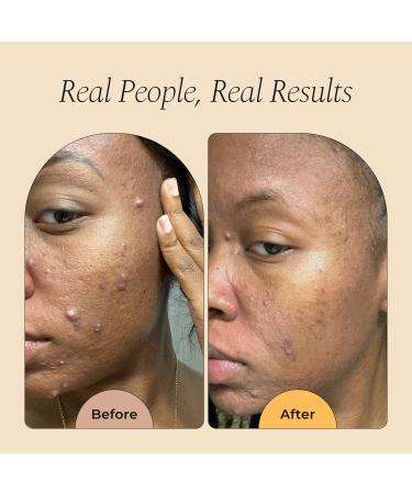 Glo Melanin Turmeric & Kojic Foaming Face Wash Brightening Foaming Cleanser with Scrubber Top Rose Water Vitamin C Aloe & Kojic Acid Natural Paraben-Free 4 fl oz 120 ml - Buy Online on GoSupps.com