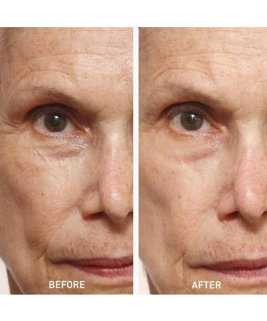 Buy skyn ICELAND Icelandic Relief Eye Cream 14g - Ultimate Hydration for Dark Circles & Puffiness | International Shipping Available - Buy Online on GoSupps.com