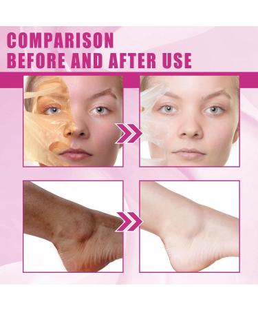 Extra Strength Yellow Peeling Oil | Exfoliating Solution for All Skin Types - Dark Skin Dead Skin Remover (3.87 Fl Oz / 110ML - Buy Online on GoSupps.com