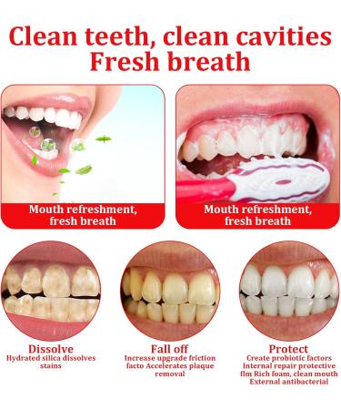 2 Pcs Sp-6 Fresh Breath Toothpaste Sp-6 Toothpaste Sp-6 Probiotic Toothpaste Probiotic Toothpaste Fresh Breath Toothpaste Removes Stains Complete Dental Care - Buy Online on GoSupps.com