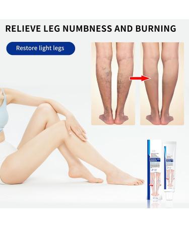 KONGDY Varicose Vein Cream 2 Counts Varicose Veins Improves Blood Circulation Veins Soothing Skin Cream for Legs - Buy Online on GoSupps.com