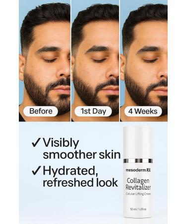 Mesoderm RX Collagen Revitalizer Nourishing Cream with Retinol Peptides & Hyaluronic Acid Lightweight Hydrating Anti ageing-Cream for Smooth Radiant Glowing Skin 1.06 oz - Buy Online on GoSupps.com