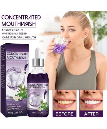 2024 New Tooth Mouth Rinsing Total Care Concentrated Mouthwash (3 PC) | Deep Cleaning Stain Removal & Fresh Breath - Buy Online on GoSupps.com