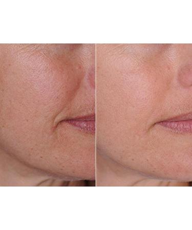 DNA CODE - Organic Argan Oil Day/Night Wrinke Reduce Cream w/Argireline M3000 Apple Stem Cell Hyaluronic Acid 2 Count (Pack of 1) - Buy Online on GoSupps.com