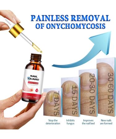 Fungal Nail Treatment for Toenail Toe Nail Fungal Treatment Anti Fungus Nail Repair and Strengthen Toenail Fungus Treatment Fungal Nail Drop Fix and Renew Damaged Cure Nail Fungus Restoring Nails - Buy Online on GoSupps.com
