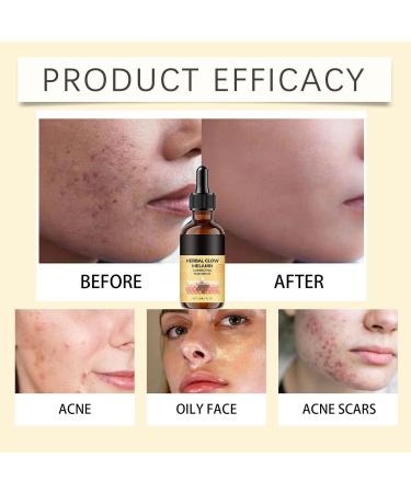  G n rique Brightening Lotion | Gentle Moisturizing Agent 30ml Facial Liquid for Women and Family Friends Daily Use Morning and Night Home Travel Makeup - Buy Online on GoSupps.com