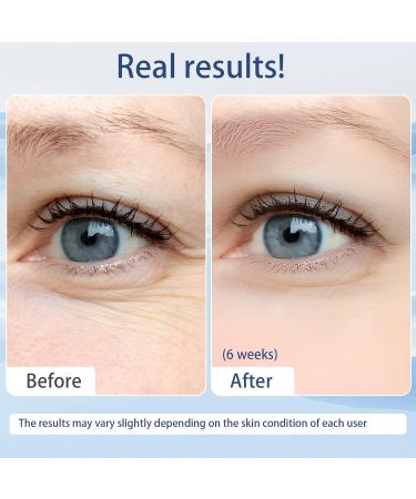 Anti-Aging Eye Cream with Caffeine & Peptide Complex | Moisturizing Serum for Dark Circles & Puffiness - Lavender Scent 20ml - Buy Online on GoSupps.com