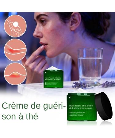  Zasdvn Facial Moisturizer - 50g Non-Greasy Soothing Moisturizing Gel Repairing Facial Care | For Men Women Adults Family Home Travel Beauty Skin Inner - Buy Online on GoSupps.com