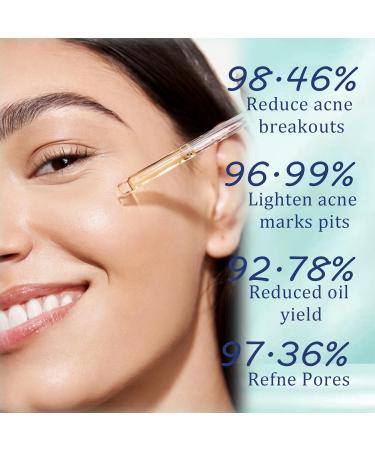 Dark Spot Correcting Glow Serum - Salicylic Acid Serum - Face Serum for Women - Acne Removal & Oil Control - Salicylic Acid Serum for Blackhead Remover - Anti Aging Serum Skincare All Skin Types - Buy Online on GoSupps.com