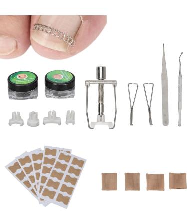 Ingrown Toenail Treatment Kit with 12 Toenail Braces Stainless Steel Corrector for Curved Ingrown Toenails - Buy Online on GoSupps.com