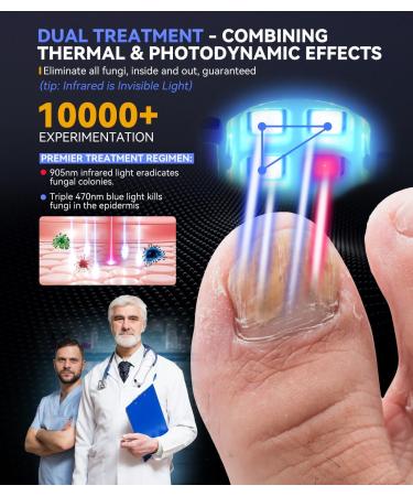 LOZLTX Upgrade Nail Fungus Laser Device Industry No.1 Laser Treatment - SGS Certified 21-day Fast-acting Anti Fungal Nail Treatment for Toenail Fungus Treatment 905nm Infrared Light 470nm Blue 02-WHITE - Buy Online on GoSupps.com