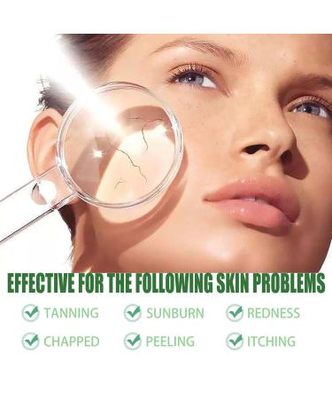 Skin Recovery Cream - Aloe After Sun Repair 100g (2pcs) | Hydrating Nourishing Lightweight Formula for Sunburn Relief & Dull Skin Repair - Buy Online on GoSupps.com