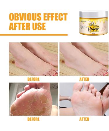 Foot Repair Moisturizer Honey Milk Wax Foot Cream Cracked Heel Repair Cream Deep Moisturizer with Natural Plant Essence Red - Buy Online on GoSupps.com