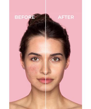 Sinoz Pure Cica Tiger Grass Color Correcting Repair Cream 15ml | Soothing & Repairing Skincare for All Skin Types | International Shipping Available - Buy Online on GoSupps.com