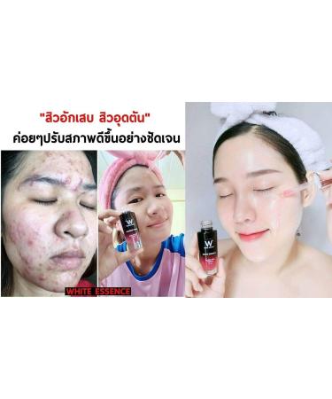 Wink White Essence Serum 15ml - Brightening & Hydrating Concentrated Formula for Radiant Skin - Buy Online on GoSupps.com