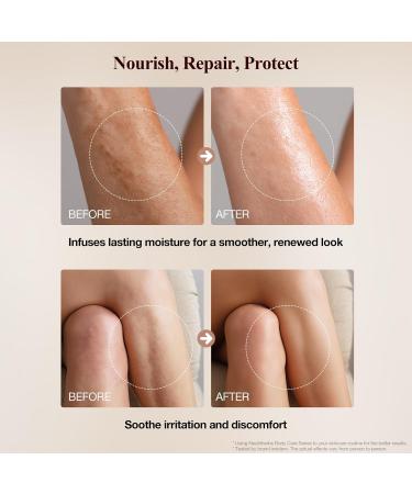 Neutriherbs Shea Body Butter 280G | Triple Nourishment with Shea Cocoa Butter & Sweet Almond Oil | Skin Barrier Repair Cream for Very Dry & Sensitive Skin | Soothes Rough Cracked Skin - Buy Online on GoSupps.com