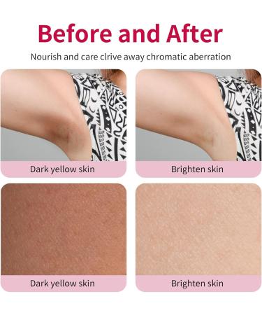 Ninnyi Armpit Cream for Thigh Knees Elbows Leg - Buy Online on GoSupps.com