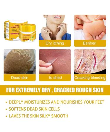  Dous Dous Banana Feet Anti Crack Cream for Dry Feet | 30g Foot Softening Cream with Olive Oil and Vitamin E for Foot Care for Men and Women - Buy Online on GoSupps.com