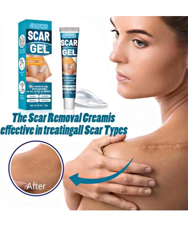 Scar Gel 20 G Effective in Treating Scars C-Section Scars Stretch Marks Acne Surgery Burns Effective On Old and New Scars - Buy Online on GoSupps.com