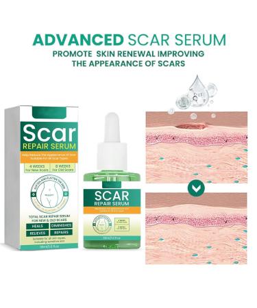 ScarRevita Advanced Repair Serum - Powerful Solution for All Types of Scars (3PCS) - Buy Online on GoSupps.com