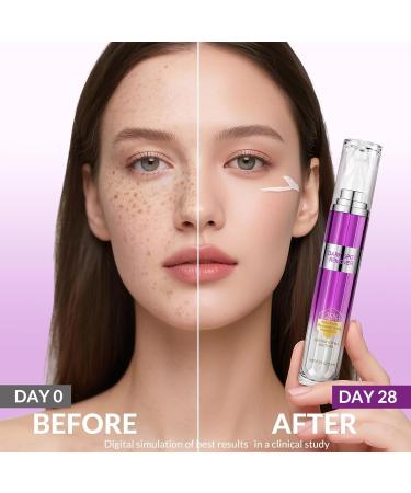 Dark Spot Remover for Face and Body Age Spot Sun Spot Freckles Remedy Corrector Serum Melasma Treatment for Face Advanced Fade Cream for Uneven Skin Tone with 360 Roller Massage Ball 0.5 FL oz - Buy Online on GoSupps.com