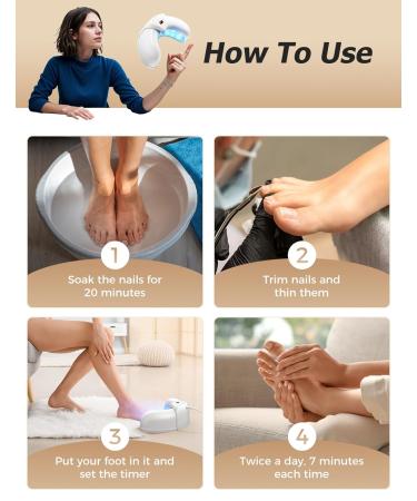 Nail Fungus Light Device for Fast Home Treatment | Repair Discolored Nails & Treat Onychomycosis Safely - International Shipping Available - Buy Online on GoSupps.com