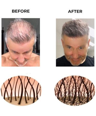 Coloured Hair Thickening Fibres by Keratech Pro 12ml | Instantly Fuller and Thicker hair | Advanced 100% Natural Keratin formula | Light Blonde - Buy Online on GoSupps.com