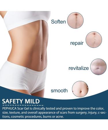 Medical Grade Silicone Scar Sheets - 1.6 x 120 Inch - For Old & New Scars - Safe & Painless Scar Removal - Face, Body, Surgery, C-Section, Keloid, Burn - 7 Months Supply - Buy Online on GoSupps.com