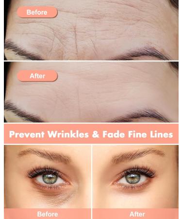 Silicone Forehead Wrinkle Patch Set | Reusable Patches for Forehead & Eyes | Anti-Wrinkle Silicone Patches with Metal Applicator & Tin Case | International Shipping Available - Buy Online on GoSupps.com