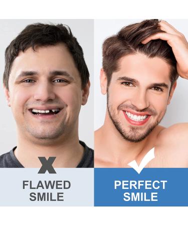 Temporary Tooth Repair Kit - DIY Replacement for Missing & Broken Teeth - Heat Fit Beads for Confident Smile - Buy Online on GoSupps.com