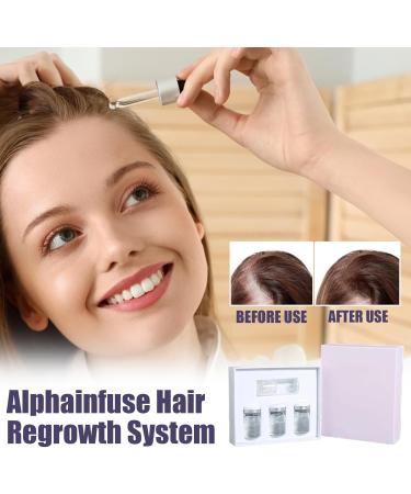 Byeaon Hair Regrowth System Scalp Health Treatment Regrowth Product for Men 20g Lightweight and Fast Absorbent Supports Scalp Nutrition for Daily Use - Buy Online on GoSupps.com