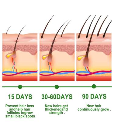 Plant-Based Rosemary Hair Oil 120ml - Essential Oil for Hair Growth & Skin Care | Nourish Scalp & Stimulate Growth for Men & Women - 4PCs - Buy Online on GoSupps.com