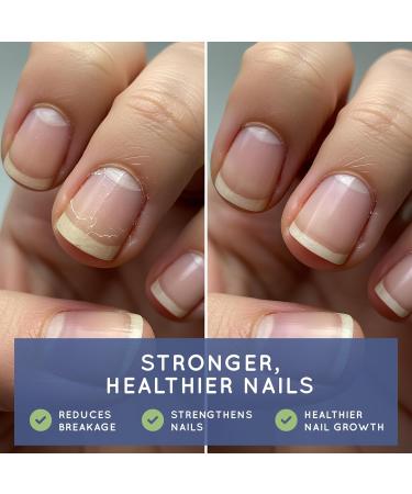 Essential Source Biotin (Biotina Vitaminas) - Hair Skin Nails Vitamins for Women & Men - 5000 mcg - Hair Growth Support Supplements - 90 Tablets - with Revytalyz 5, Vitamin A, C, B12 - Made in USA 90 Count (Pack of 1) - Buy Online on GoSupps.com