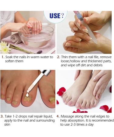 Extra Strong Fungal Nail Treatment for Toenails - Nail Fungus Care Solution - Repair & Renew Damaged Nails - Buy Online on GoSupps.com