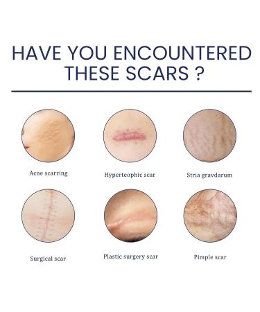 Pregnancy Scar Gel - Moisturizing & Rejuvenating Skincare Must-Have for First Trimester - Dark Blue - Buy Online on GoSupps.com