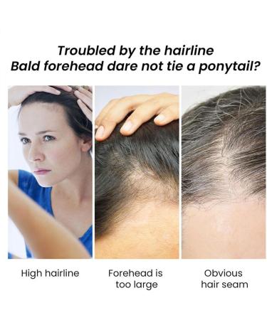 Hair Growth With Scalp Oil Jojoba Hair Density Oil - For Hair Anti- Natural For Hair Regrowth For Women And Men With Or - Buy Online on GoSupps.com