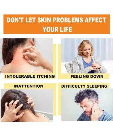 New Zealand Bee Venom Psoriasis Treatment Cream - 5pcs | Professional Solution for All Skin Types - Buy Online on GoSupps.com