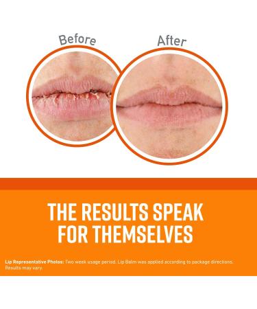 O'Keeffe's Lip Repair Balm - Dry Cracked Lips Relief (4-Pack: 3 Cooling + 1 Unscented) - Buy Online on GoSupps.com