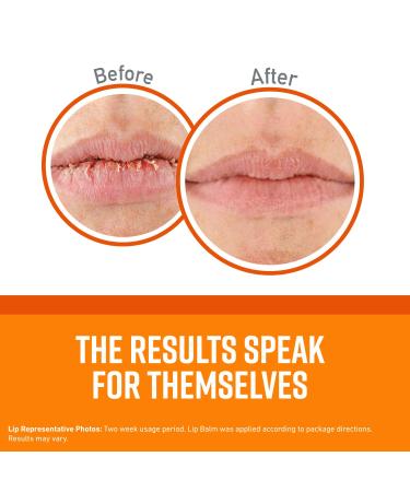 O'Keeffe's Unscented Lip Repair Lip Balm Stick for Dry, Cracked Lips - Pack of 2 - Buy Online on GoSupps.com