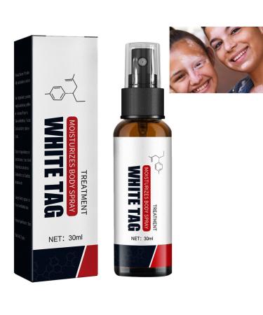 KOAHDE Psoriasis Treatment Spray Vitiligo Relief Spray Psoriasis Control Face and Body Cream Soothing and Moisturizing Coal Tar Psoriasis Cream Spray Psoriasis Control White Spot Spray 30ml 1PC