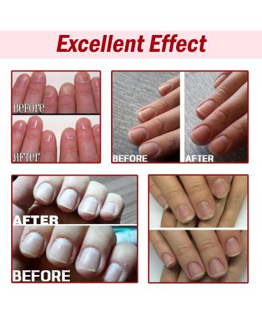 Red Nail Polish Gel Nail Polish Water-Based & Quick Dry Peel-Off Cherry Red Nail Varnish for Women Girls Kids No UV Needed (Cuticle Oil) - Buy Online on GoSupps.com
