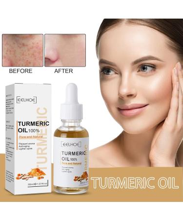 Turmeric Dark Spot Corrector Serum 2022 New Natural Turmeric Repair Face Serum Facial Moisturizing Essence Bright Skin Dark Spot Corrector Face Whitening Serum - Buy Online on GoSupps.com