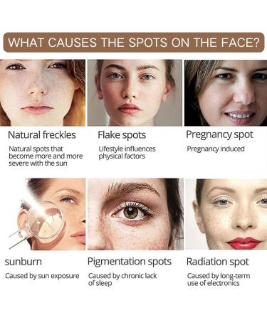 Tranexamic Acid Serum Tranexamic Acid Skin Brightening Serum Dark Spot Correcting Glow Serum Moisturiser For Acne Prone Skin with Hyaluronic Acid Arbutin Hyperpigmentation and Even Skin Tone - Buy Online on GoSupps.com