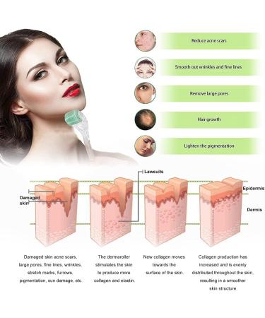 KOI BEAUTY Derma Roller 1.5mm with 200 REAL NEEDLES Professional Microneedling Roller for Face Body Scalp Beard Dermaroller for Beard growth Hair Growth Roller for Men Women include Storage Case - Buy Online on GoSupps.com