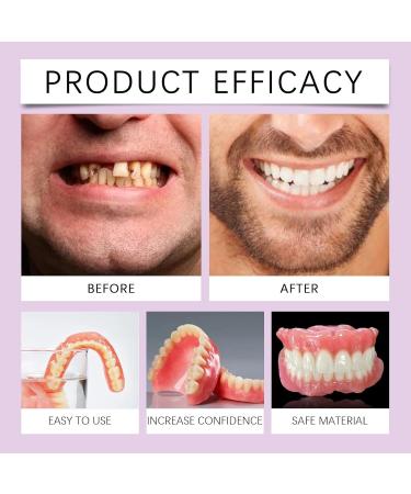 Denture Aesthetic Kit - Natural Smile Comfort Fit Easy To Use Instant Enhancement For Gaps & Appearance(3PC) - Buy Online on GoSupps.com